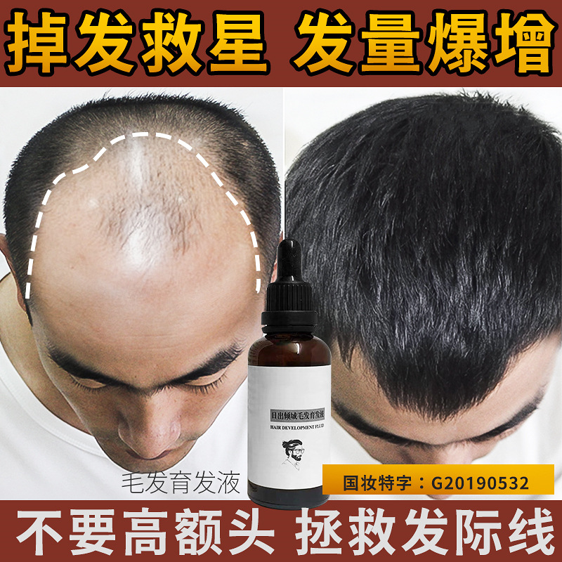 Hair growth liquid Hair growth liquid Growth agent Densification hairline nutrient liquid essence anti-detoxification device for male and female students Application Scenario