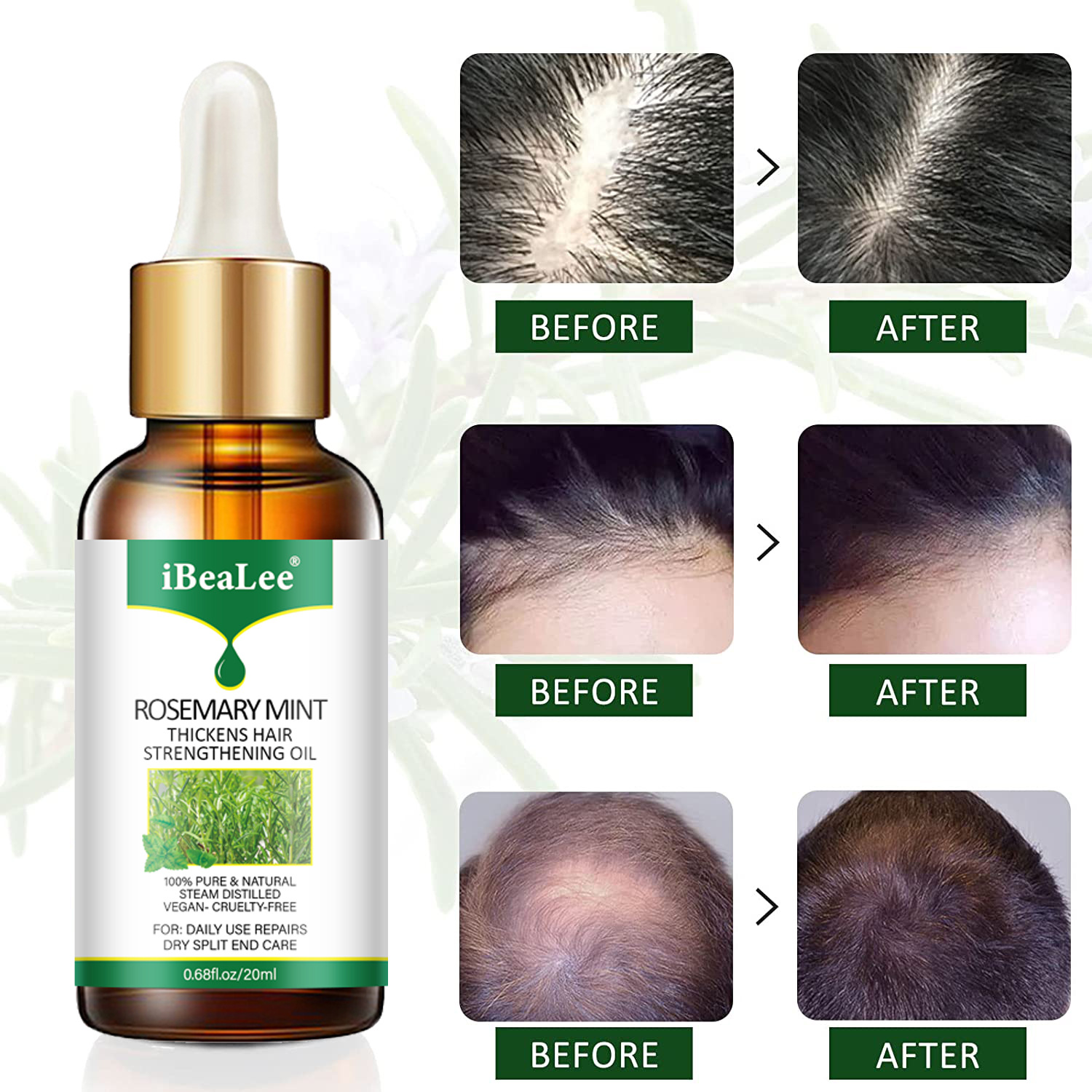 iBeaLee Cross-border Herbal Hair Growth Serum Hair Growth oil Hair growth agent Hair nutrition solution Specification drawing