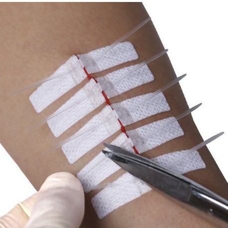 Cross-border medical seamless adhesive tape, tensioning and reducing adhesive tape, cesarean section scar hyperplasia inhibition chain band-aid details Picture