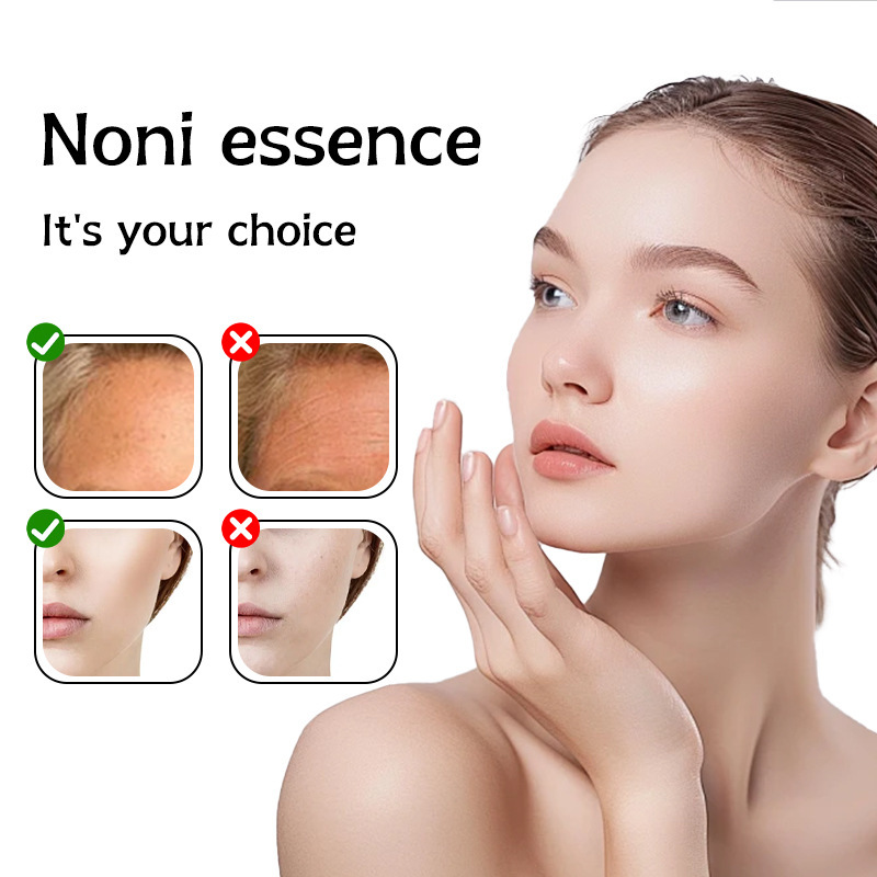 Cross-border new Noni essence Noni Essence Facial Moisturizing, Hydrating and Anti-wrinkle ampoule Essence Application Scenario