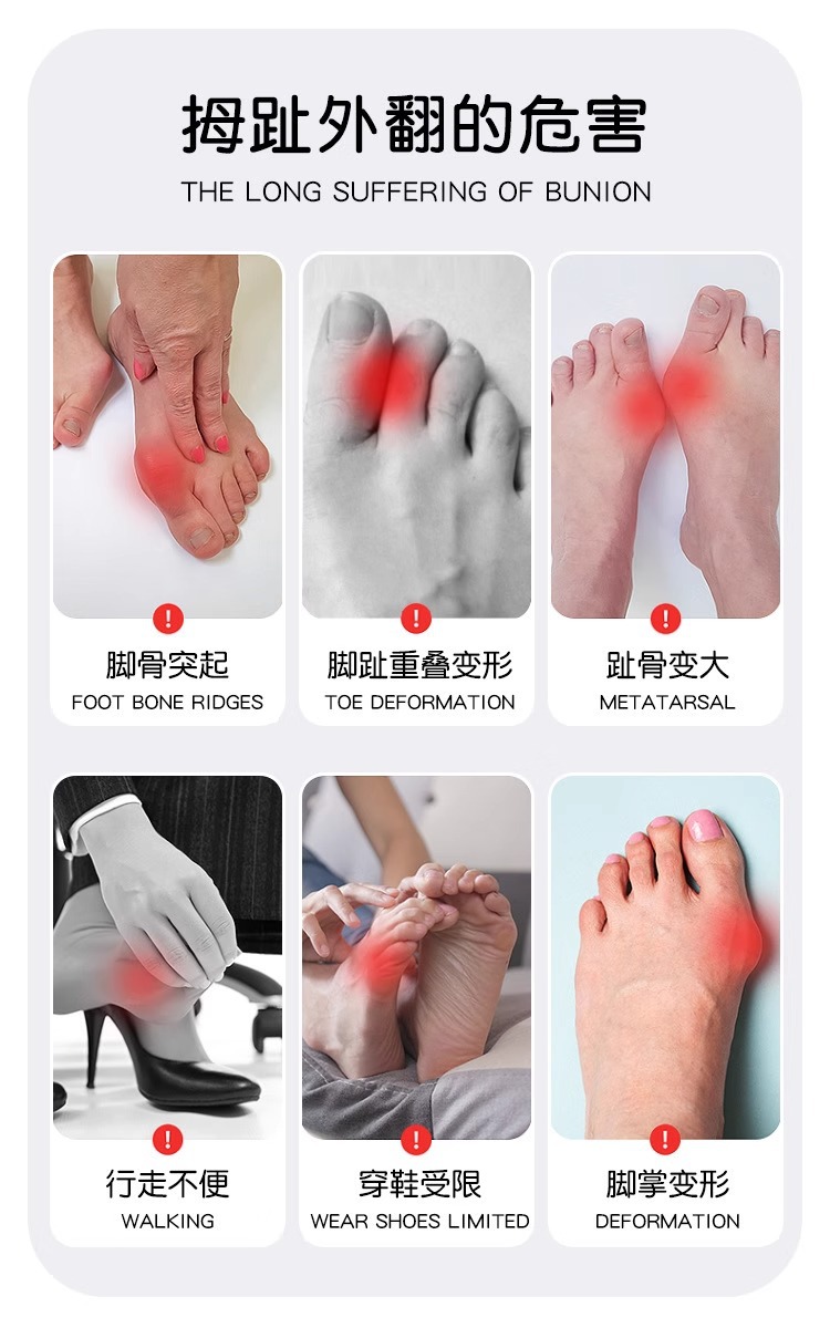 Sock stall, one-piece delivery, thin thumb stretch straightener, auxiliary toe stretch straightener, foot bone divider, big toe straightener, one-piece delivery pic 7