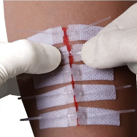 Cross-border medical seamless adhesive tape, tensioning and reducing adhesive tape, cesarean section scar hyperplasia inhibition chain band-aid Specification image