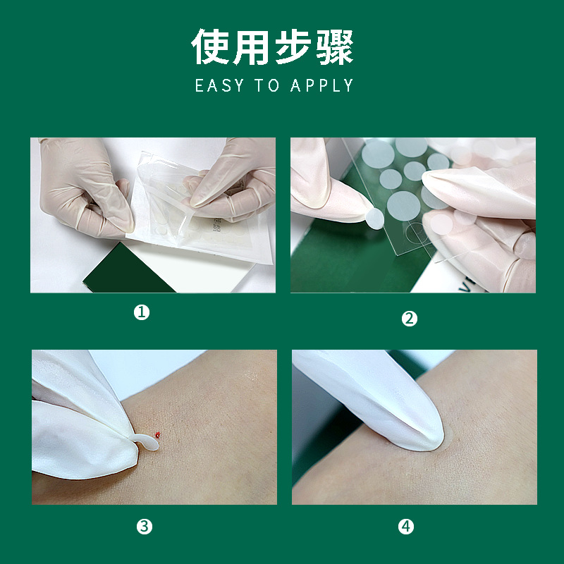 鼻贴、鼻膜实物图