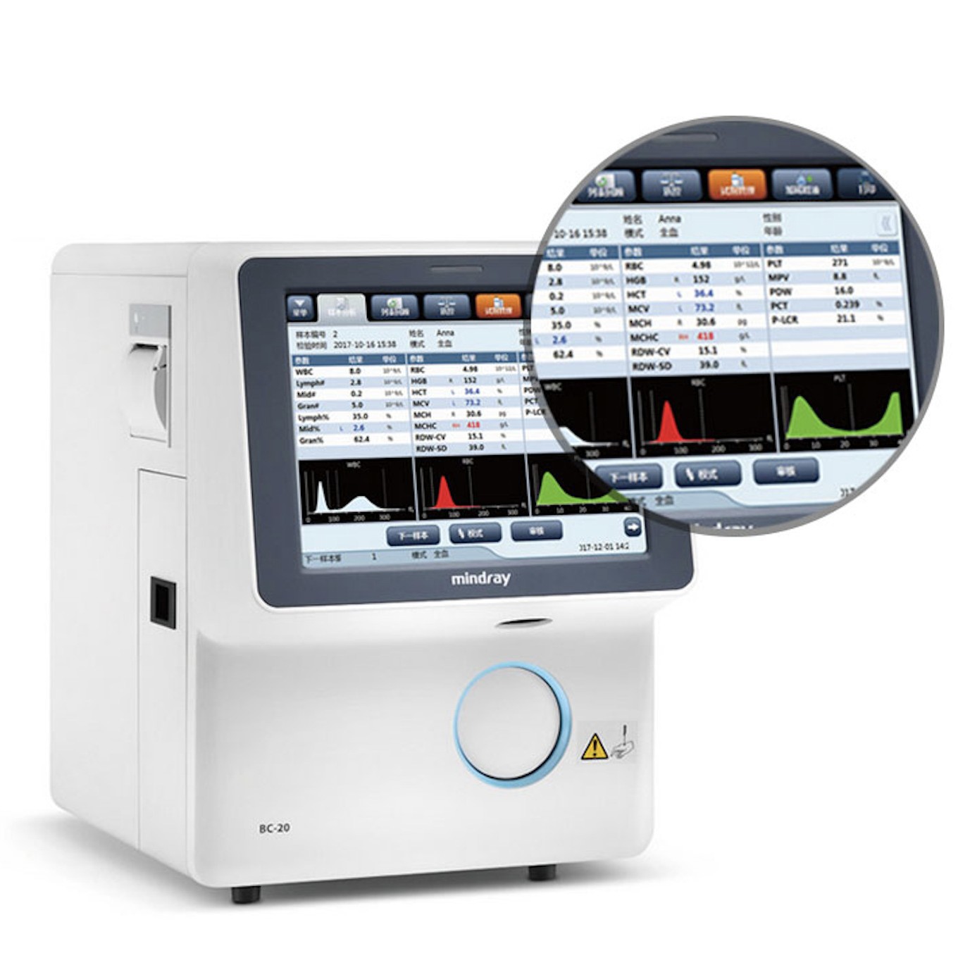 Mindray fully automatic blood analyzer BC-20 medical three-category blood analyzer testing machine CBC details Picture