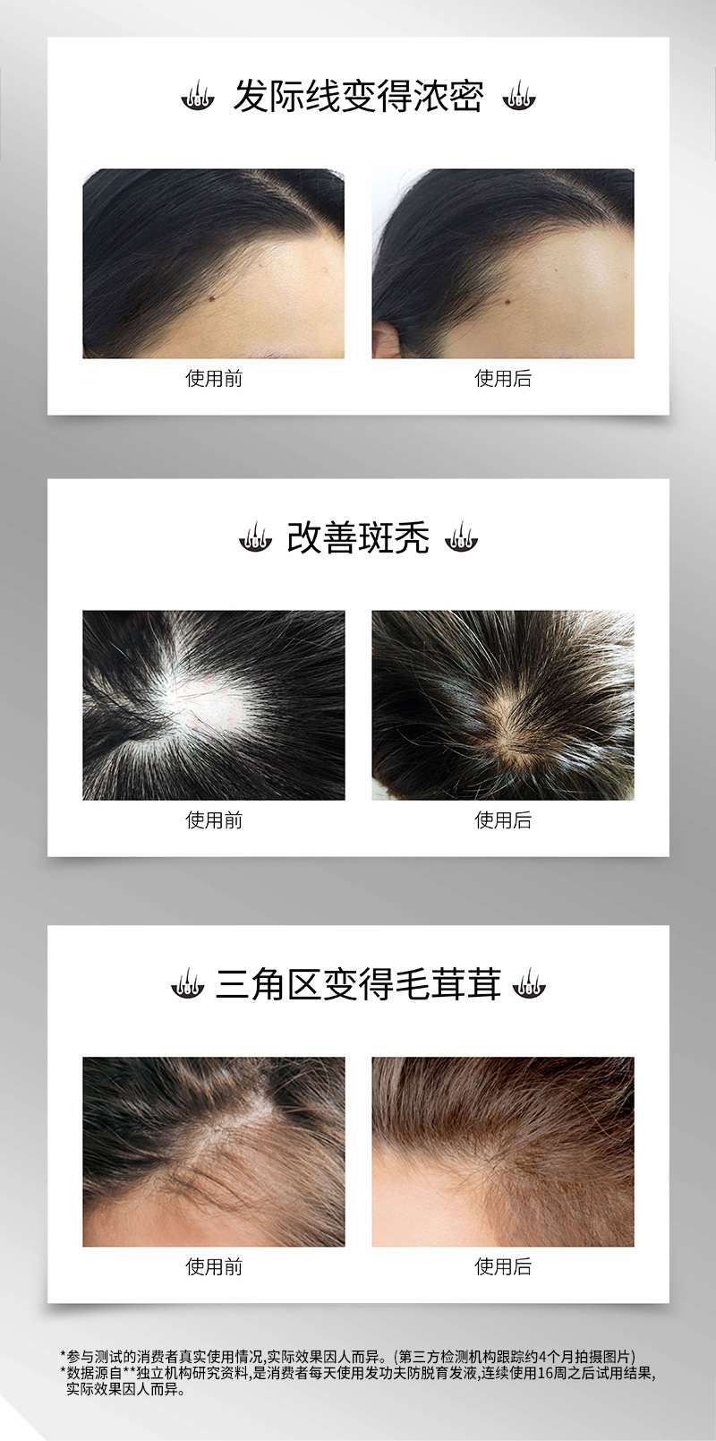 发功夫滚珠防脱育发液30ml生发液激活毛囊增发液生长液防脱育发水详情9