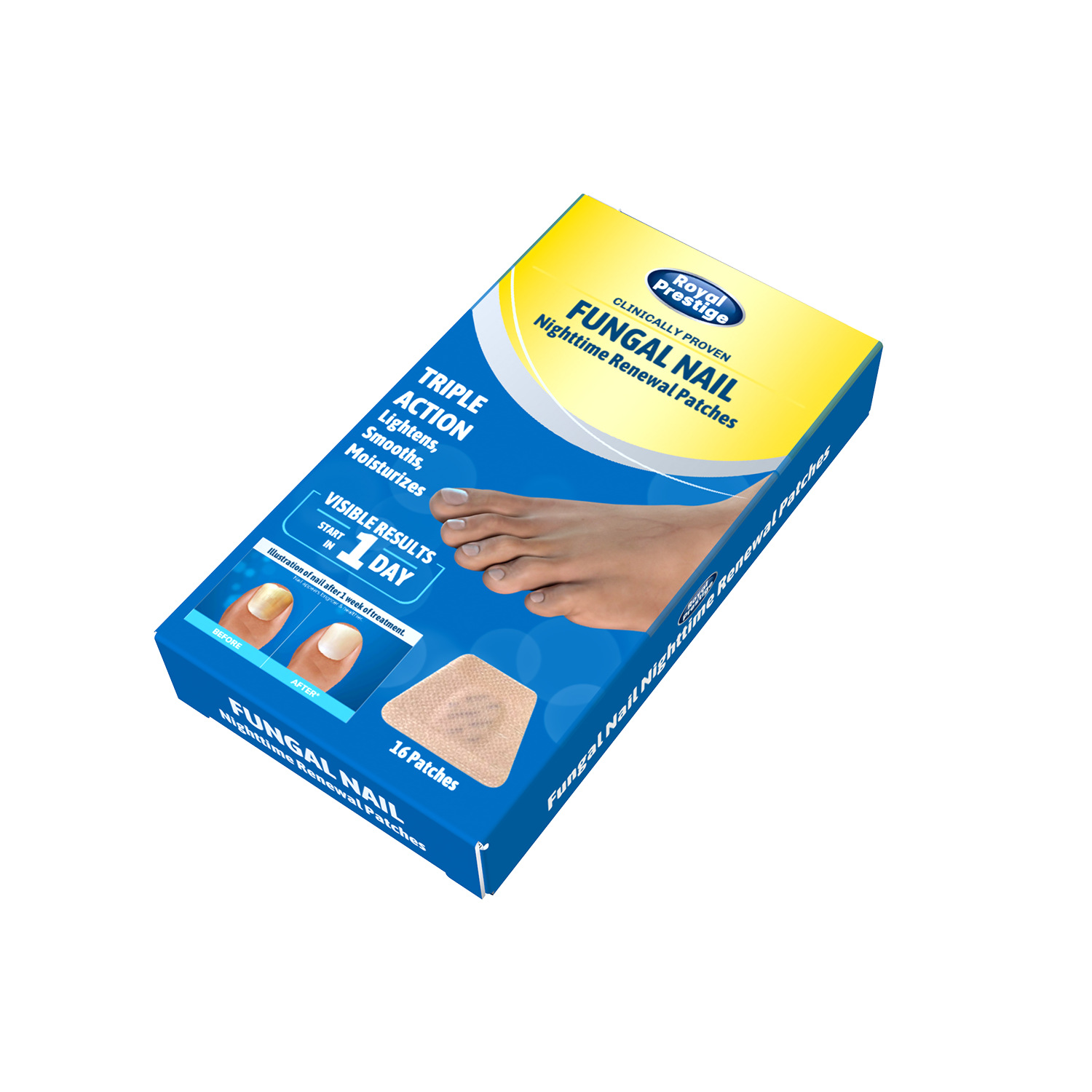 Cross-border foreign trade toenail repair patch, onychomycosis care, toenail soft nail, ingrown nail thickening type, bright nail groove repair patch details Picture