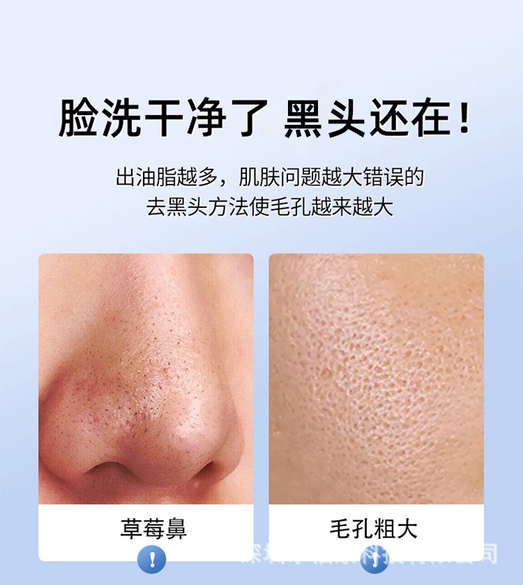 去黑头仪ems微电流铲皮机美容仪家用脸部黑头铲毛孔清洁吸出神器详情2