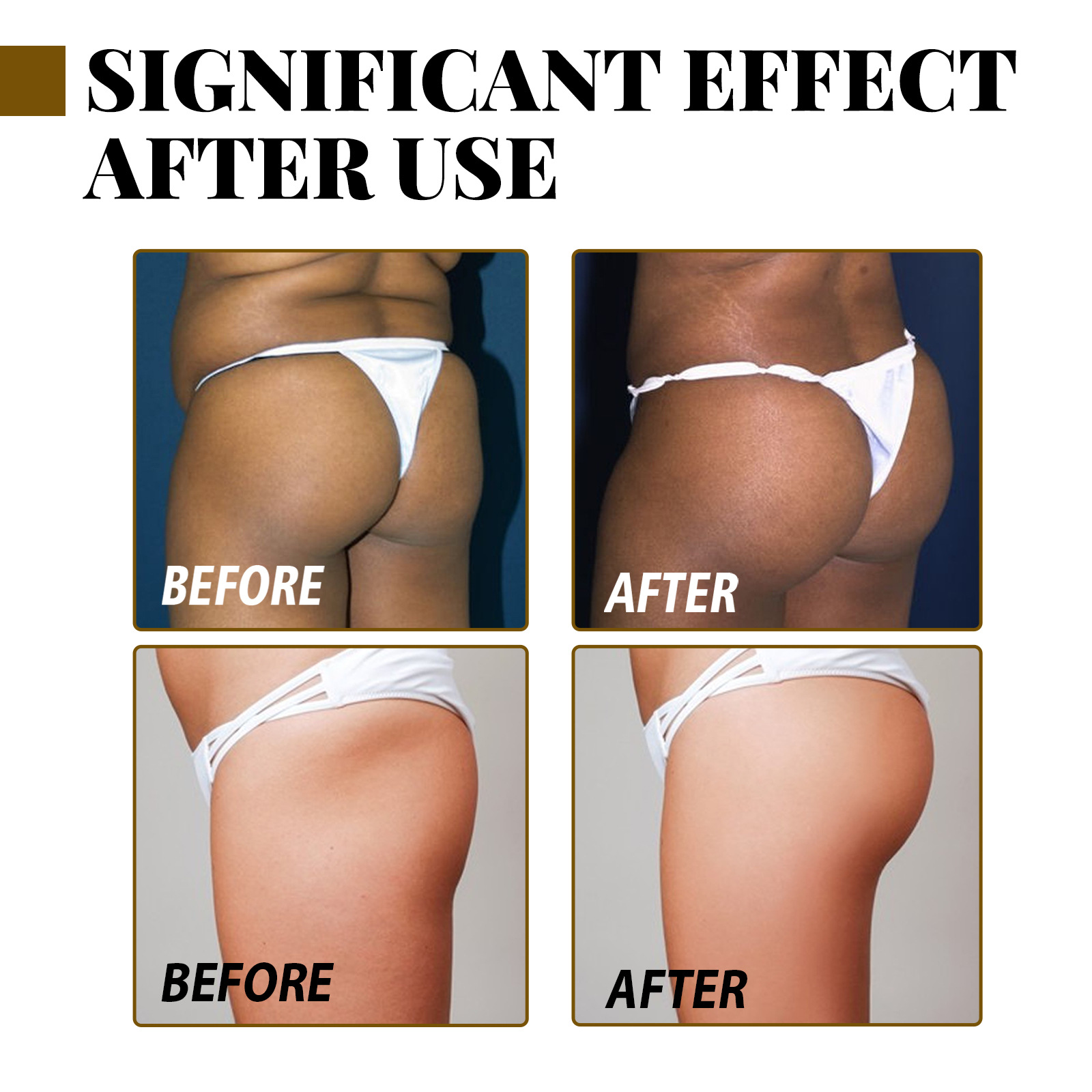 Eelhoe Butt Essential Oil Lift Firming Buttocks Massage Highlights The Curves Of Buttocks And Buttocks Moisturizing Treatment details Picture