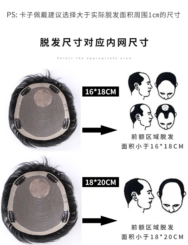 A man with a wig, short hair, a cool, thin, seamless bald head, a bald head, real hair strands, hair replacement for men, and a hair replacement piece on the top of his head Application Scenario