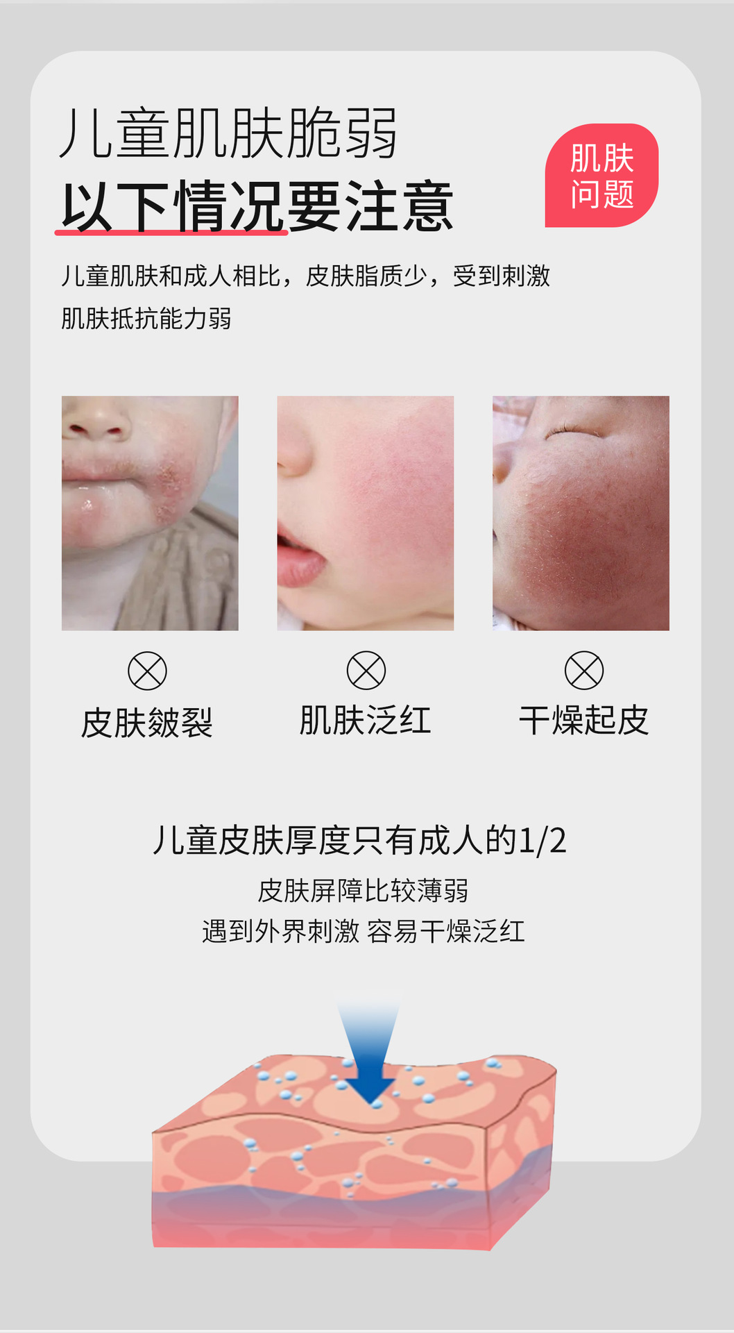 医儿乐IERLEI防皴舒缓滋润霜婴儿防皴防皴保湿霜婴儿童专用皴裂膏详情3