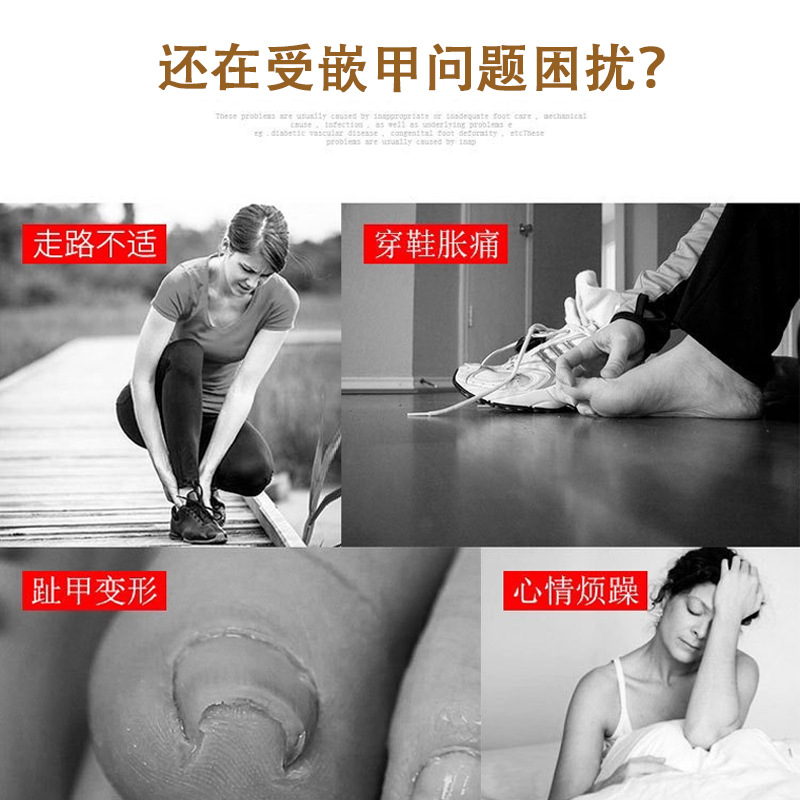 Nail groove ingrown nail corrector, nail art tools, toenail curl corrector, nail remover, nail corrector, nail straightener Specification image