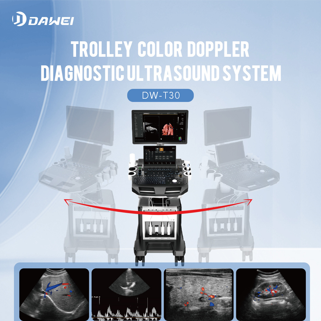 Cross-border exclusive four-dimensional color Doppler ultrasound machine DW-T30 Doppler ultrasound diagnostic instrument, paired with dual-probe B-ultrasound machine Specification image