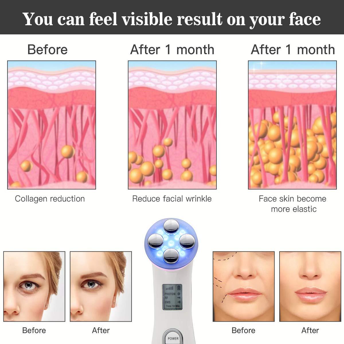 Led Color Skin Tender Instrument Ems Micro-Current Lift Rf Rf Line Electroperforation Needle-Free Beauty Plastic Beauty Instrument details Picture
