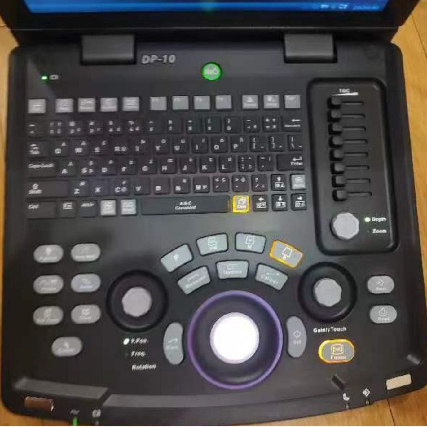 Mindray DP-20 ultrasound scanner is a medical ultrasound instrument, a black-and-white portable ultrasound machine, and an ultrasound diagnostic system Application Scenario