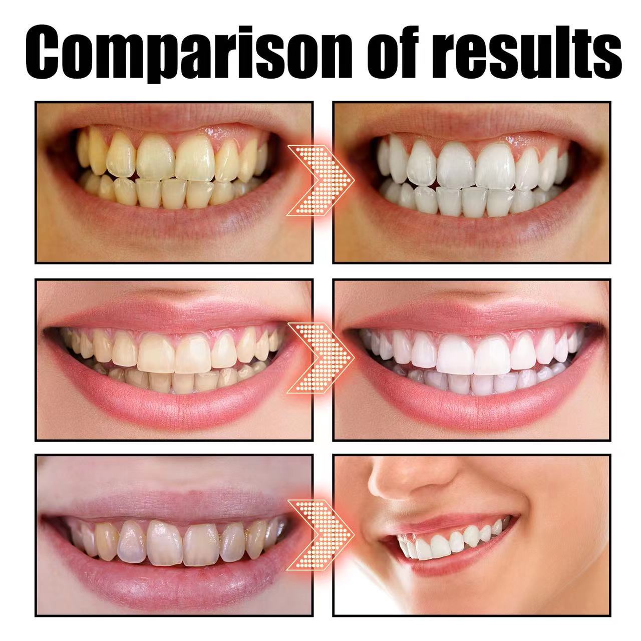 Purple V34 toothpaste for whitening, removing stains, oral cleaning and eliminating odors hismile toothpaste Application Scenario