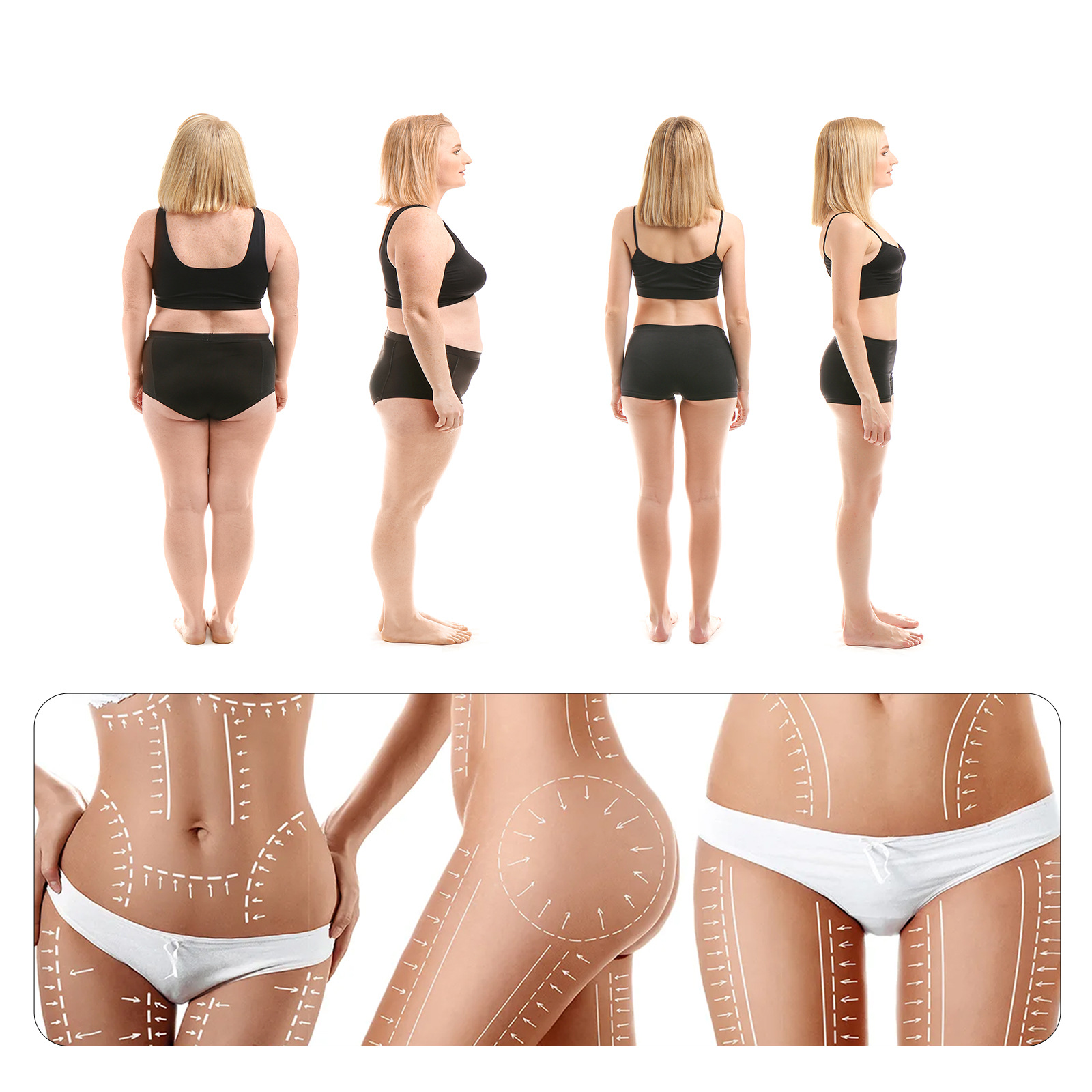 South Moon Ginger Massage Ball Shaping Slimming Body Lifting And Tightening Skin Ball Massage Abdominal Tightening details Picture