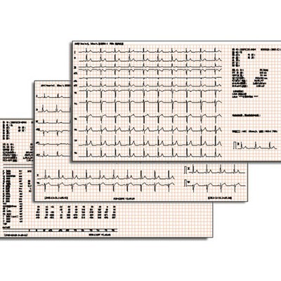 Specialized for foreign trade export of digital three-channel, six-channel and twelve-channel electrocardiogram machines and portable automatic analysis electrocardiogram instruments Application Scenario