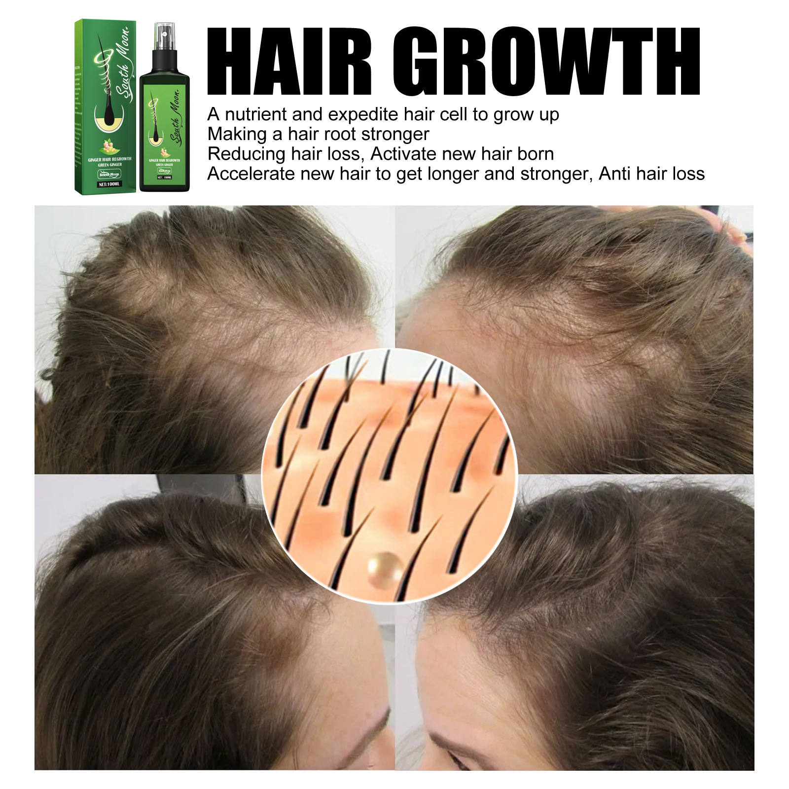 South Moon Hair Nourishing Growth Spray Moisturizes Fast Growth Anti-Defixation Hair Spray Growth Solution Application Scenario