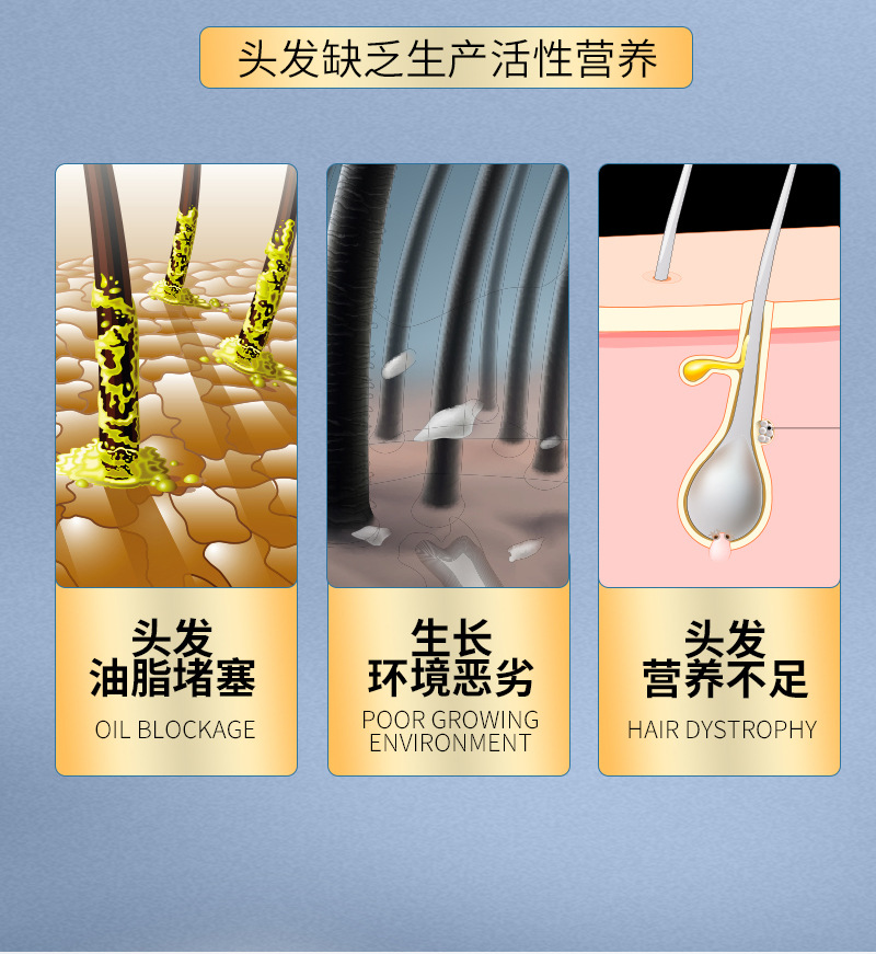 发功夫生姜洗发水防脱发固发育发正控油蓬松去屑洗头膏露男女详情5
