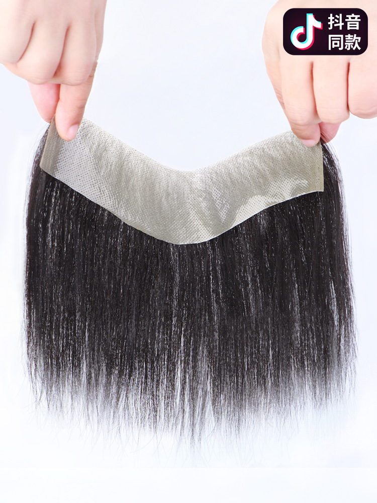 Fully hand-woven biological scalp wig, men's hairline false hair patch, real hair invisible high forehead men's forehead hair replacement patch