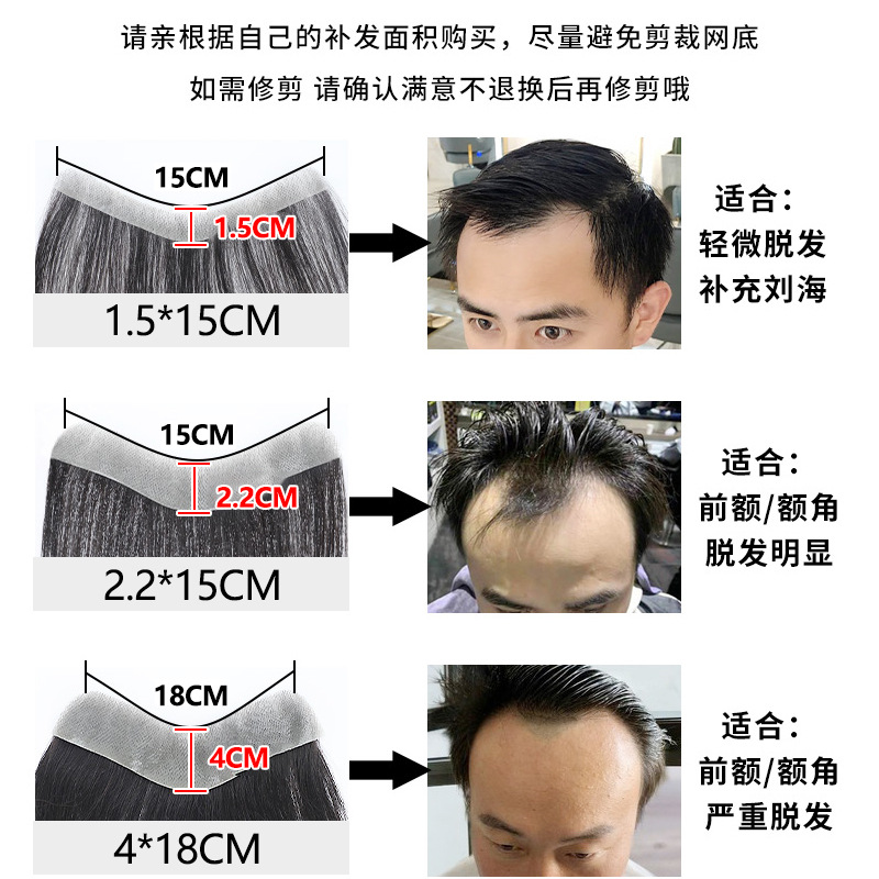 Fully hand-woven biological scalp wig, men's hairline false hair patch, real hair invisible high forehead men's forehead hair replacement patch details Picture