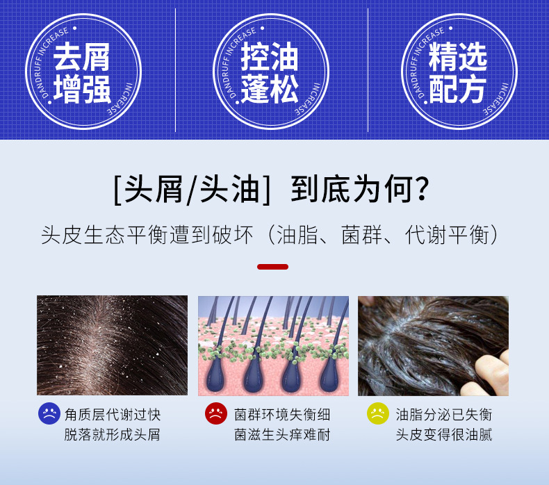 Wholesale new aloe vera anti-dandruff shampoo, anti-itch, oil-control, fluffy, refreshing and smooth, improving frizzy hair cream pic 2