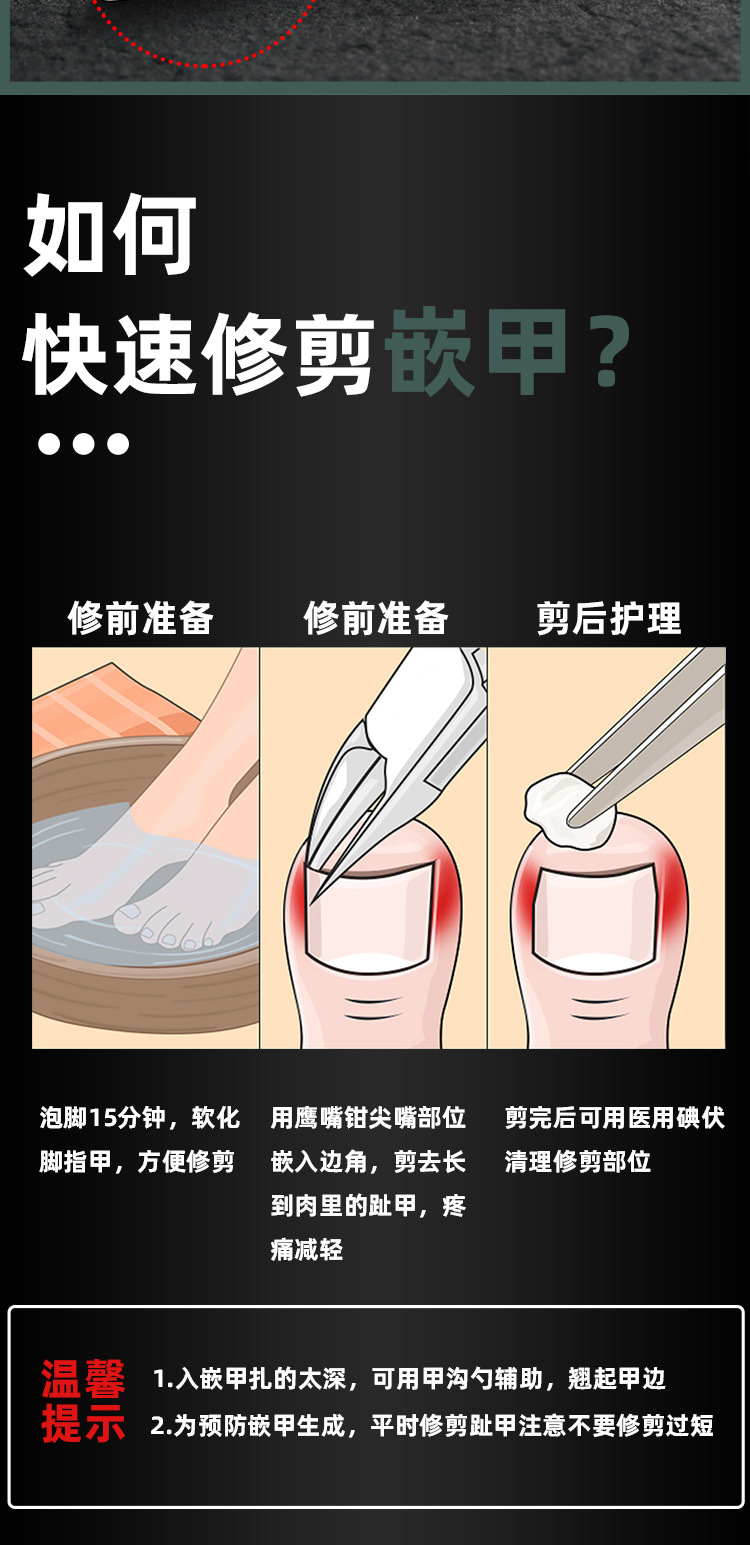 New types of nail tools for nail grooves, including eagle-beak pliers, toe nail pliers and nail clippers, are directly supplied by the manufacturer pic 10