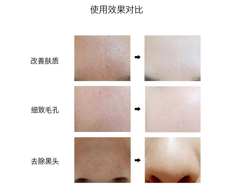 细软毛洗脸刷洁面毛孔清洁器去黑头洁面仪化妆美容工具批发详情19