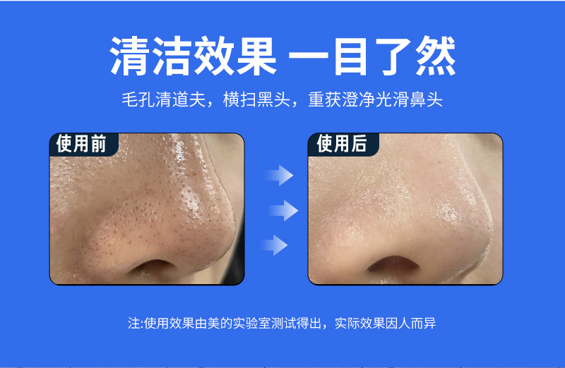 Blackhead suction device, electric facial hot compress skin peeling machine, portable beauty cleansing device, acne removal device, pore cleaner, exclusively for export. Exclusively for export pic 24