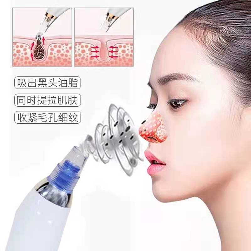 Cross-border electric blackhead suction device, facial beauty device, pore-removing machine, facial cleaning and care instrument, facial cleansing device wonder pic 3