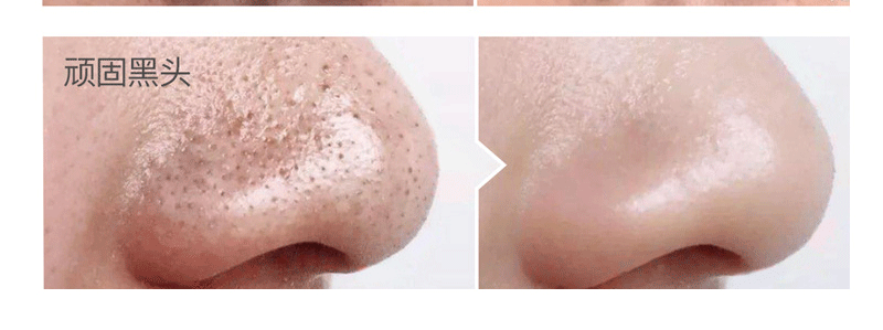 Dear She Avocado Mask, peel-off head Mask/Nose mask, clean pores, absorb oil, cross-border export pic 14