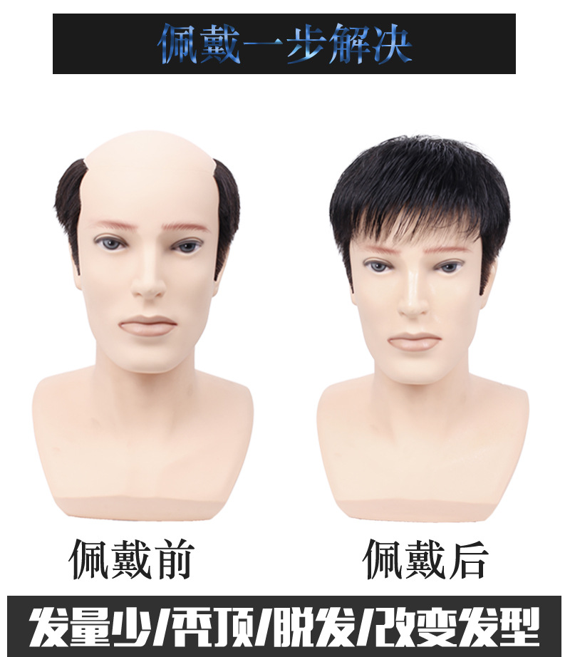 男士补发片假发套头顶补发前额秃顶补发垫接发翻盖假发真发男发块详情7