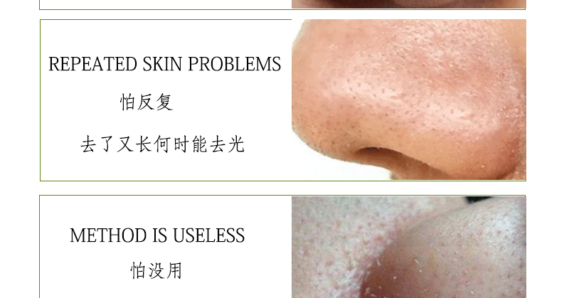 Dear She Avocado Mask, peel-off head Mask/Nose mask, clean pores, absorb oil, cross-border export pic 8