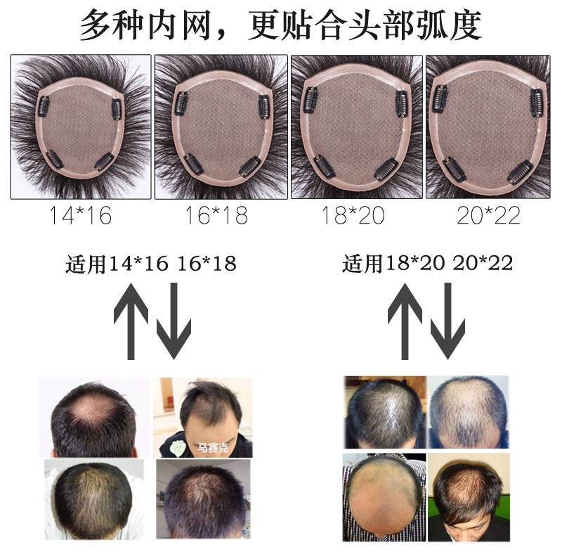 Men's wig, hair replacement piece, head cover, baldness needle hand-woven real hair, hair inch flip wig, hair replacement block, biological scalp pic 13
