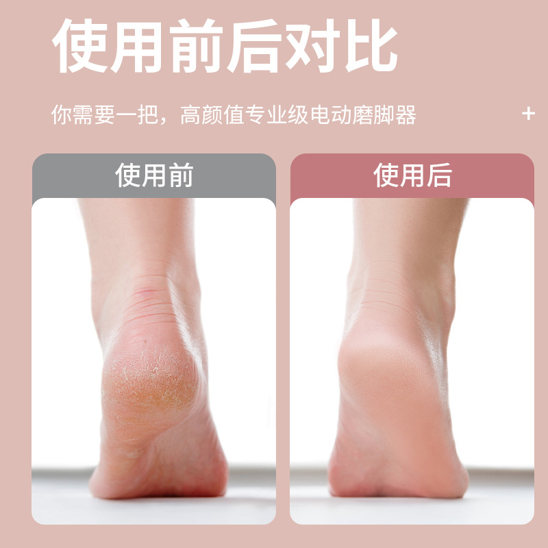新款迷你多功能磨脚器充电式便携高品质不伤肤详情11