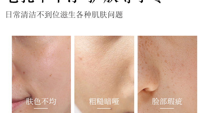 Dear She Avocado Mask, peel-off head Mask/Nose mask, clean pores, absorb oil, cross-border export pic 6