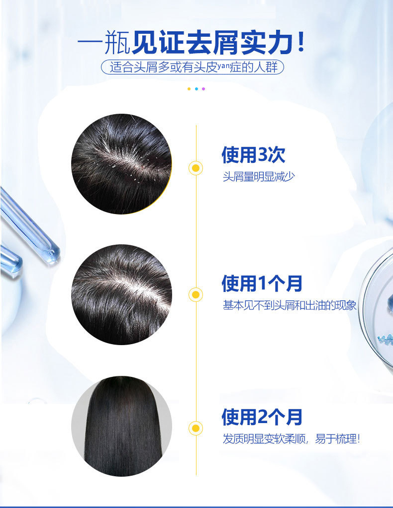 澳洲进口现货selsun 强去屑痒控由无硅油洗发水200ml洗发露详情4