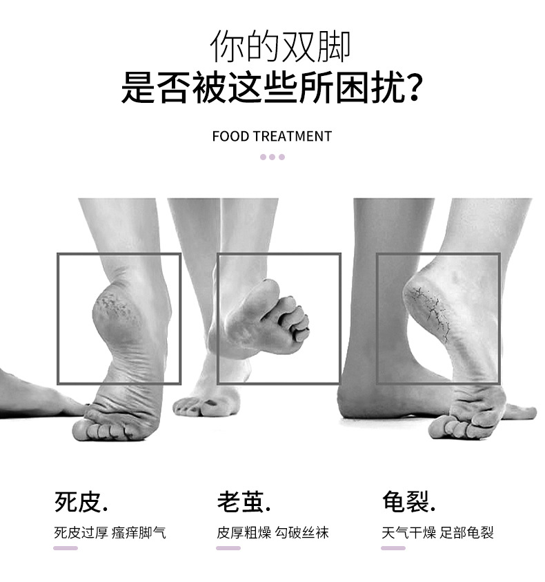 shanilak, a detachable blade foot planer for removing dead skin and calluses from feet, is a personal care foot care device pic 3