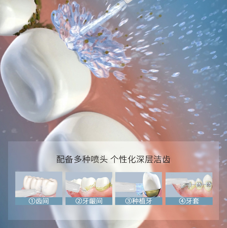 Portable electric household dental plaque removal, calculus removal, oral cleaning wonder device, teeth cleaning instrument, water flosser, teeth cleaning device pic 4