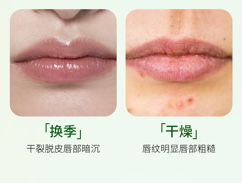 Boquan Ya Elastic and Moisturizing Eye and Lip Mask Moisturizes and nourishes the skin, protecting the eye area, lip mask and eye mask skin care products pic 3