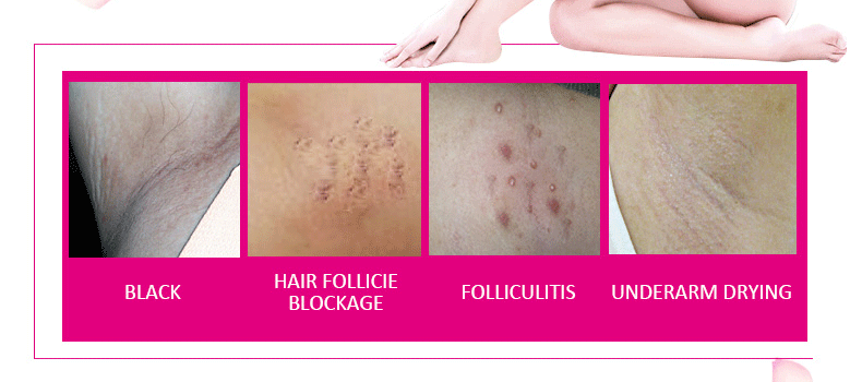 马来西亚/印尼热销 701手工香皂沐浴清洁嫩肤 护肤面霜日霜+晚霜详情2