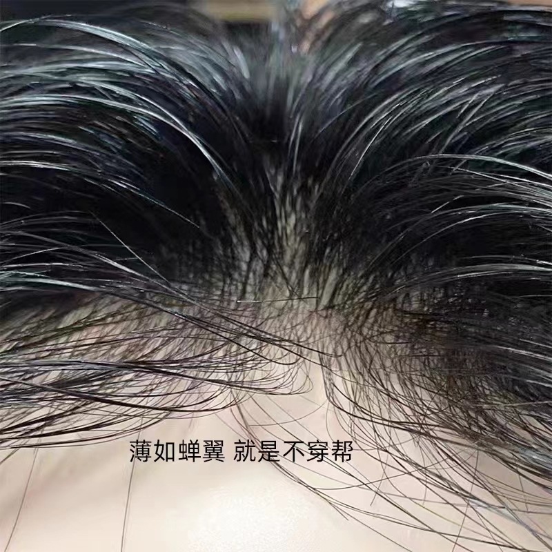 生物边递针发片男士假发隐形无痕男士头顶补发详情1