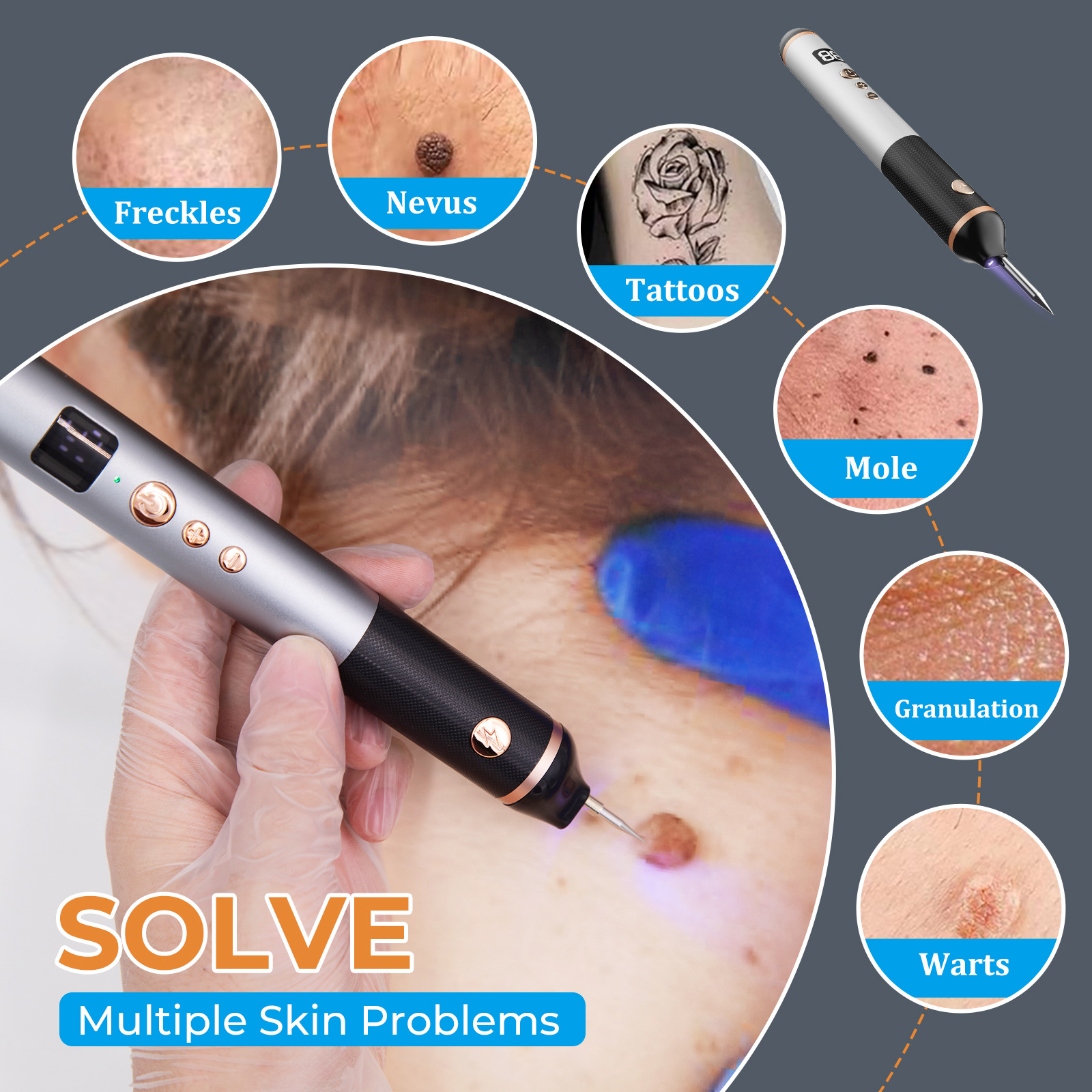 Cross-border 15-grade mole removal pen, a special beauty device for removing spots and moles, laser picosecond mole scanning pen pic 3
