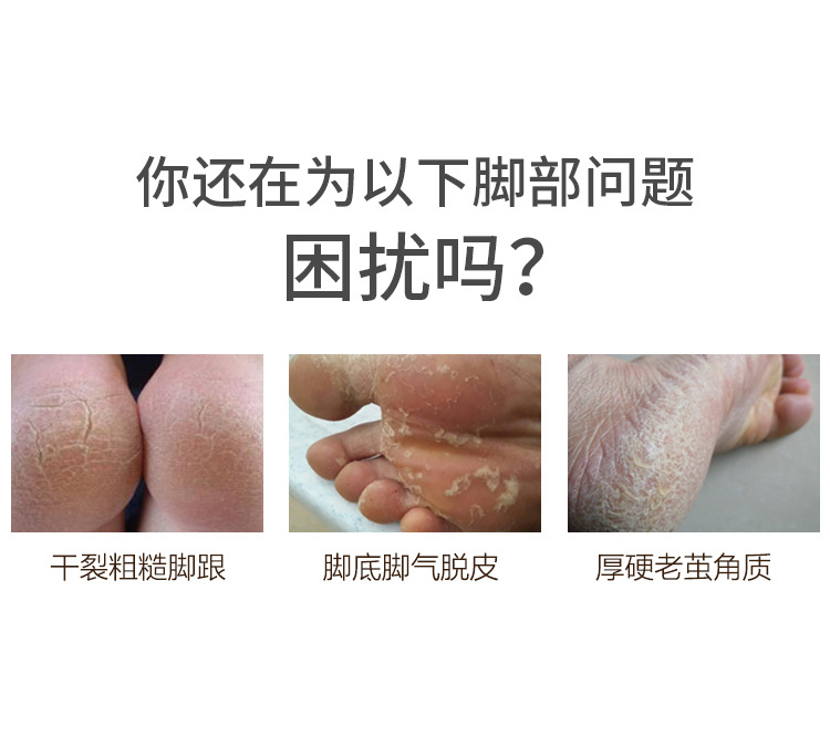 Factory wholesale double-sided sandpaper foot file, dead skin removal foot rubbing board, foot grinding device, washable sandpaper foot brush, shanilak pic 5