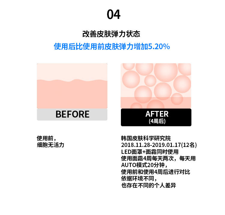 Facial color light home beauty device, red and blue LED beauty mask, skin rejuvenation mask device, home beauty device pic 26