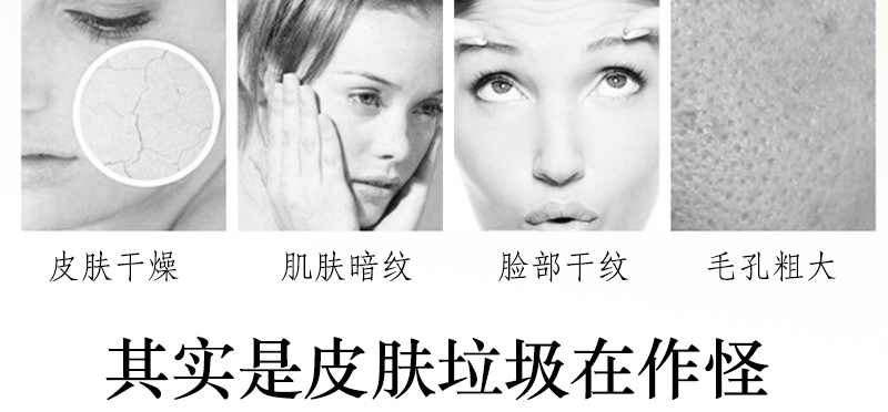 Dear She Aloe Vera Blackhead Mask Mineral Mud Acne and Blackhead Removal Nasal Mask pic 7