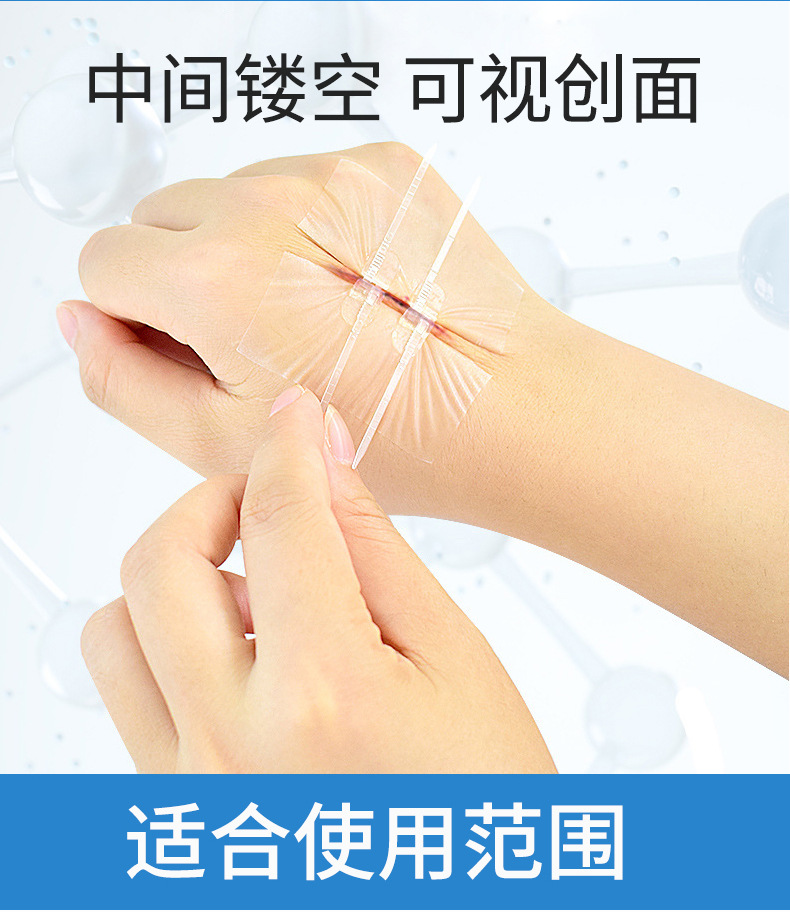 Medical skin wound tensioner, disposable tensioning band-aid for children and adults, no need for stitches pic 2
