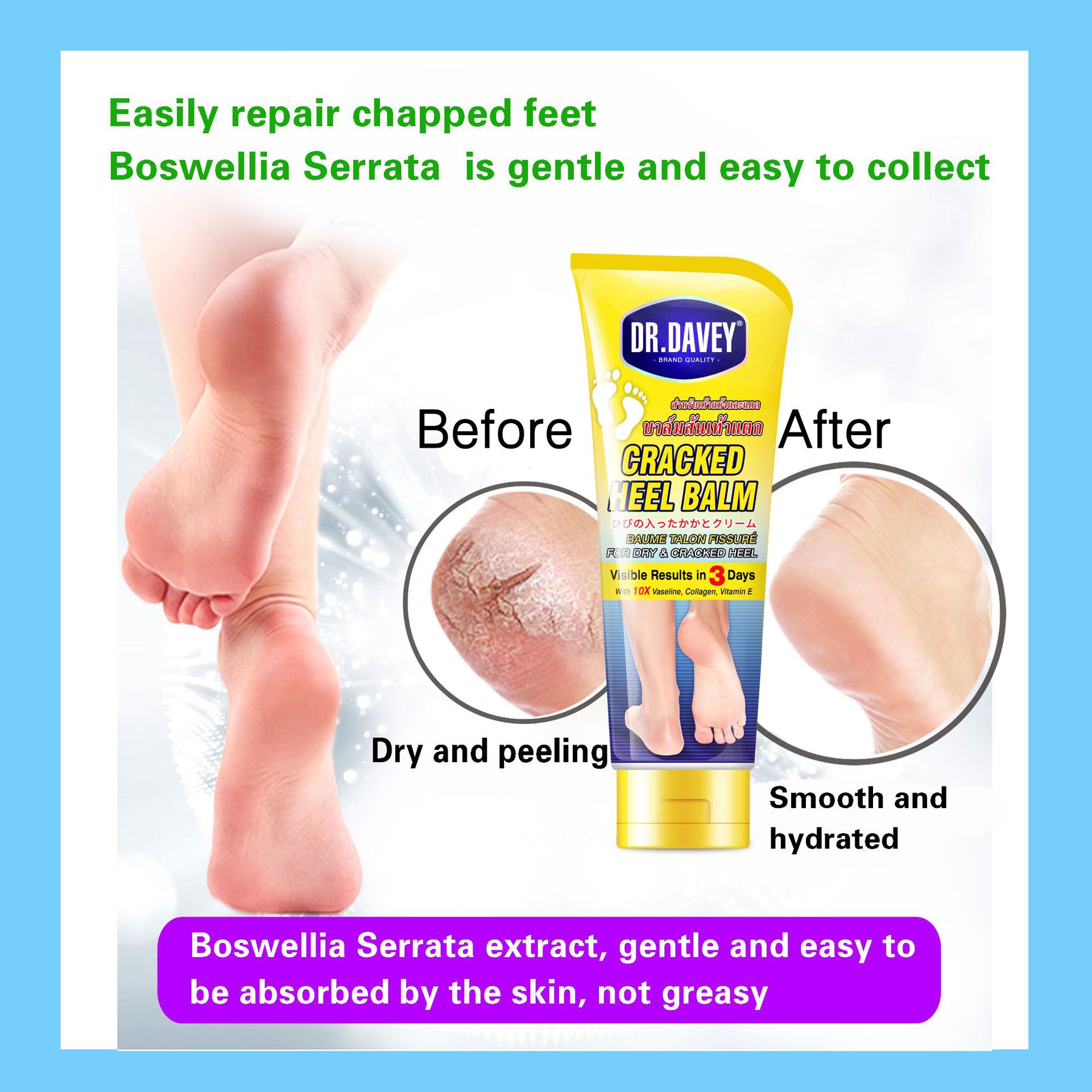 Cracked Heel Balm Moisturizing and Nourishing Protective Foot Cream pic 5