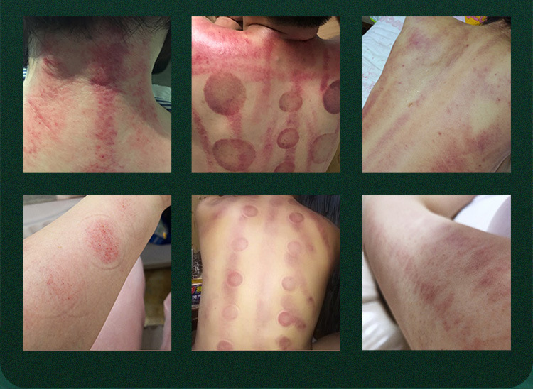 跨境新款80K多合一面部身体美容仪器 五合一六合一激光微电精雕仪详情9