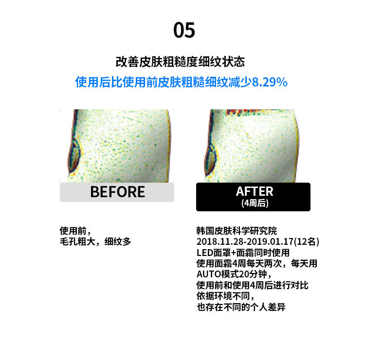 Facial color light home beauty device, red and blue LED beauty mask, skin rejuvenation mask device, home beauty device pic 27